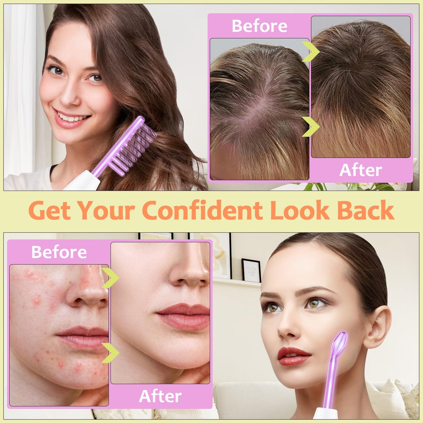 High Frequency Facial Wand -  4 in 1 Violet Portable Handheld | High Frequency Facial Machine - at Home Face Skin Wand Device with 4 Pcs Purple Glass Tubes