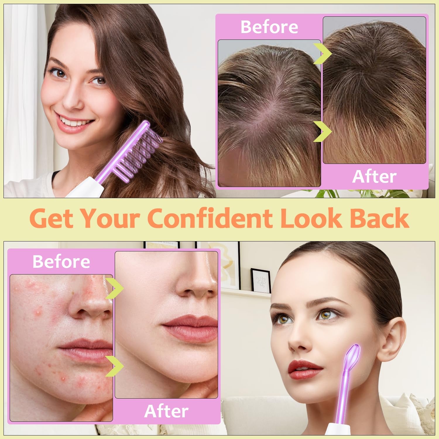 High Frequency Facial Wand -  4 in 1 Violet Portable Handheld | High Frequency Facial Machine - at Home Face Skin Wand Device with 4 Pcs Purple Glass Tubes